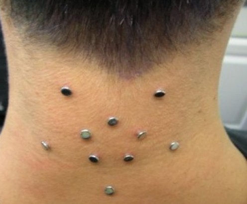 Silver Microdermals Nape Piercings Picture