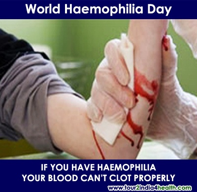 World Haemophilia Day If You Have Haemophilia Your Blood Can't Clot Properly