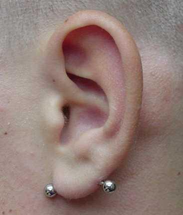 Silver Stud Anti Lobe Piercing On Left Ear