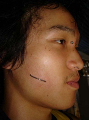 Bridge And Staple Piercing On Face