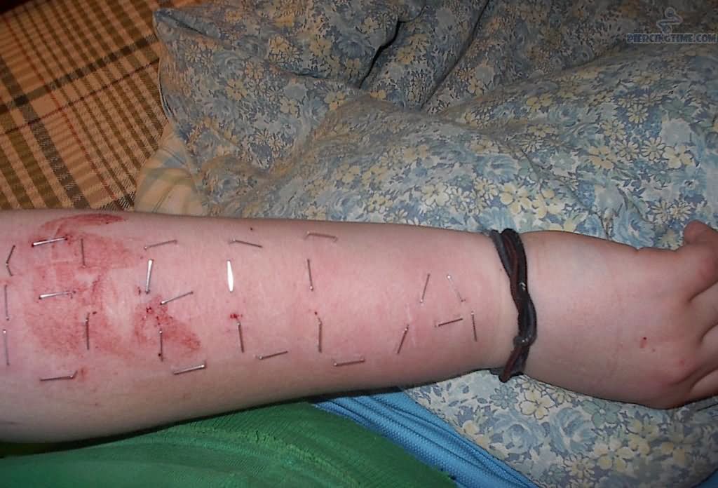 Flesh Staple Piercings on Arm