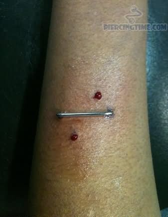 Fresh Pierced Staple Piercing On Arm