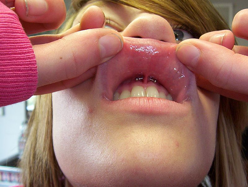 Girl Showing Her Beautiful Gum Piercing