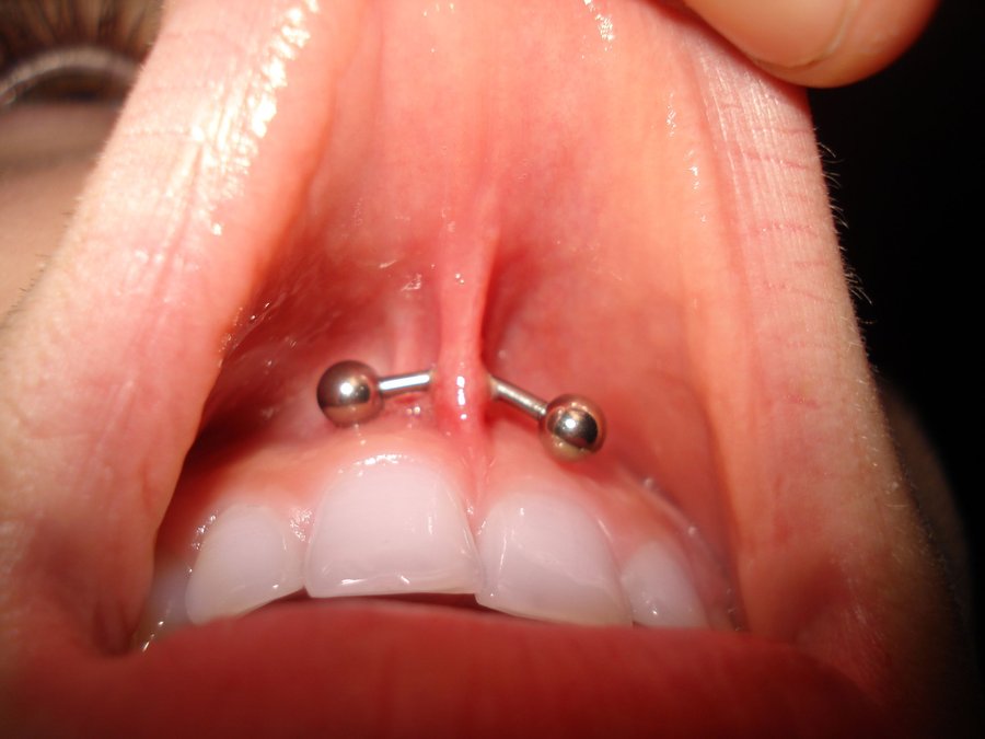 Gum Piercing With Curved Silver Barbell