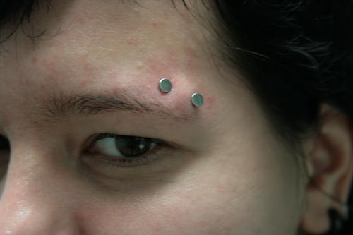 Horizontal Eyebrow Piercing With Dermals