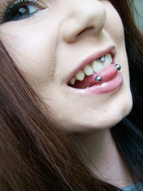 Horizontal Tongue Piercing With Gum Piercing