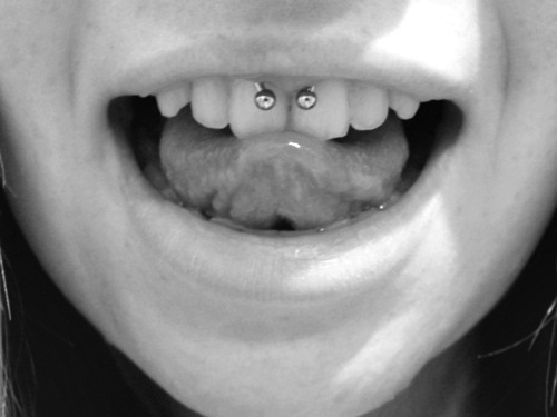 Nice Gum Piercing With Circular Barbell