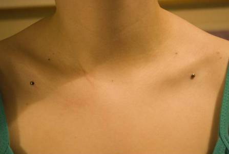 Shoulder Piercing With Dermals