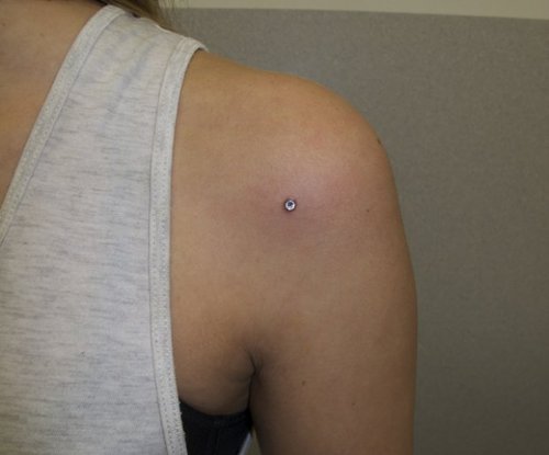 Shoulder Piercing With Single Microdermal