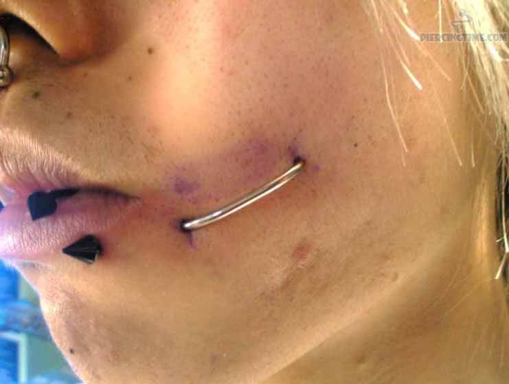 Staple Piercing On Girl Face