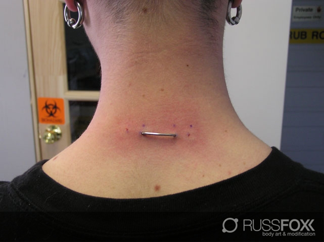 Staple Piercing On Girl Upper Back