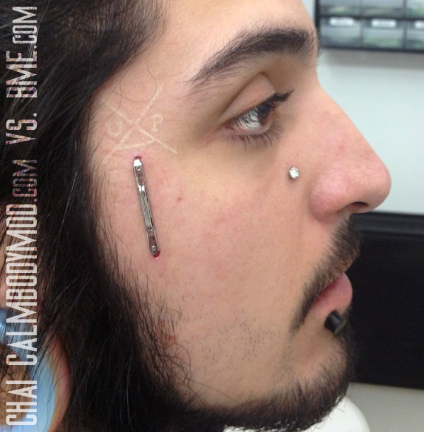 Staple Piercing On Man Face