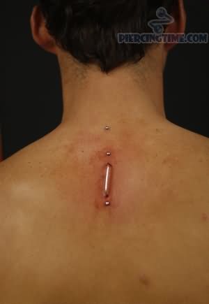 Staple Piercing On Upper Back