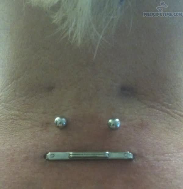 Surface And Staple Piercing On Nape