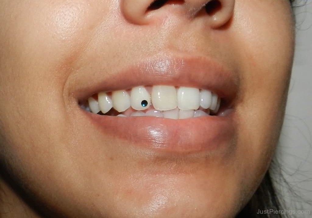 Tooth Gum Piercing With Green Gem