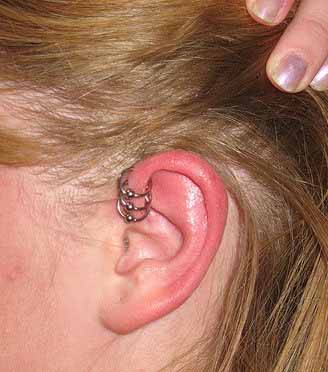 Triple Forward Pinna Piercing With Bead Rings