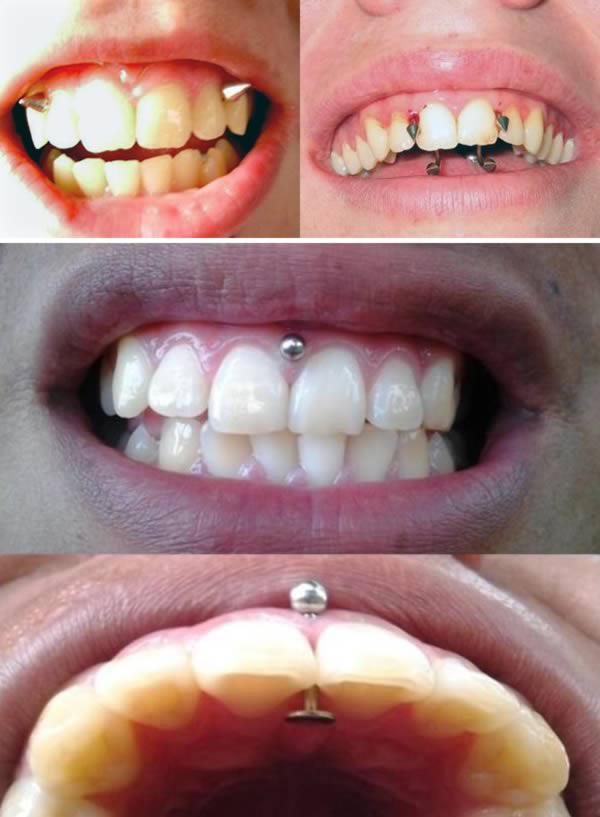 Gum Mouth Piercing Ideas