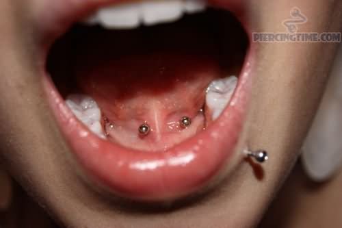 Lower Lip And Mouth Piercing With Barbell