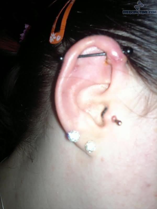 Right Ear Dual Lobe And Scaffold Piercing