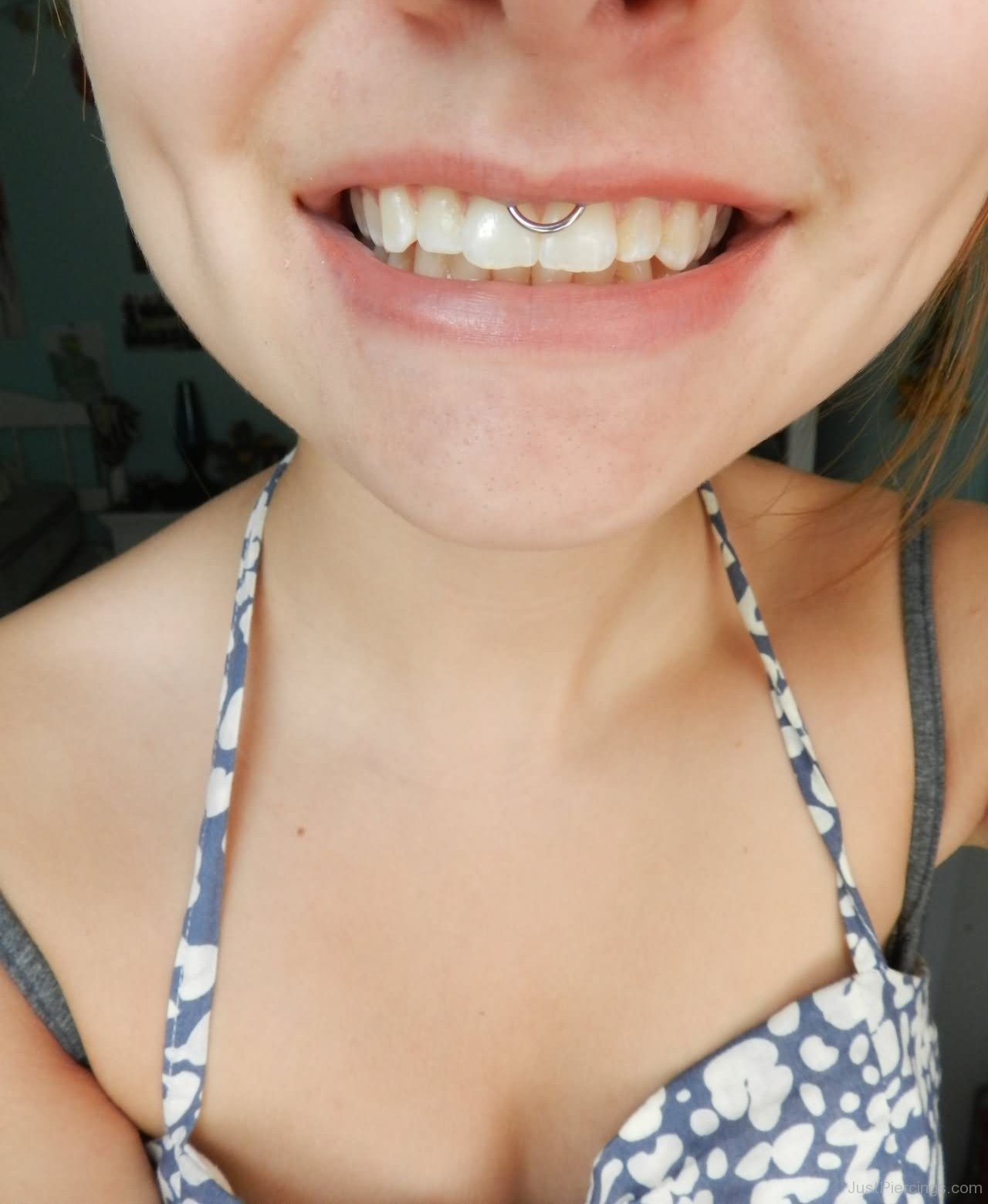 Smiley Mouth Piercing Picture For Girls