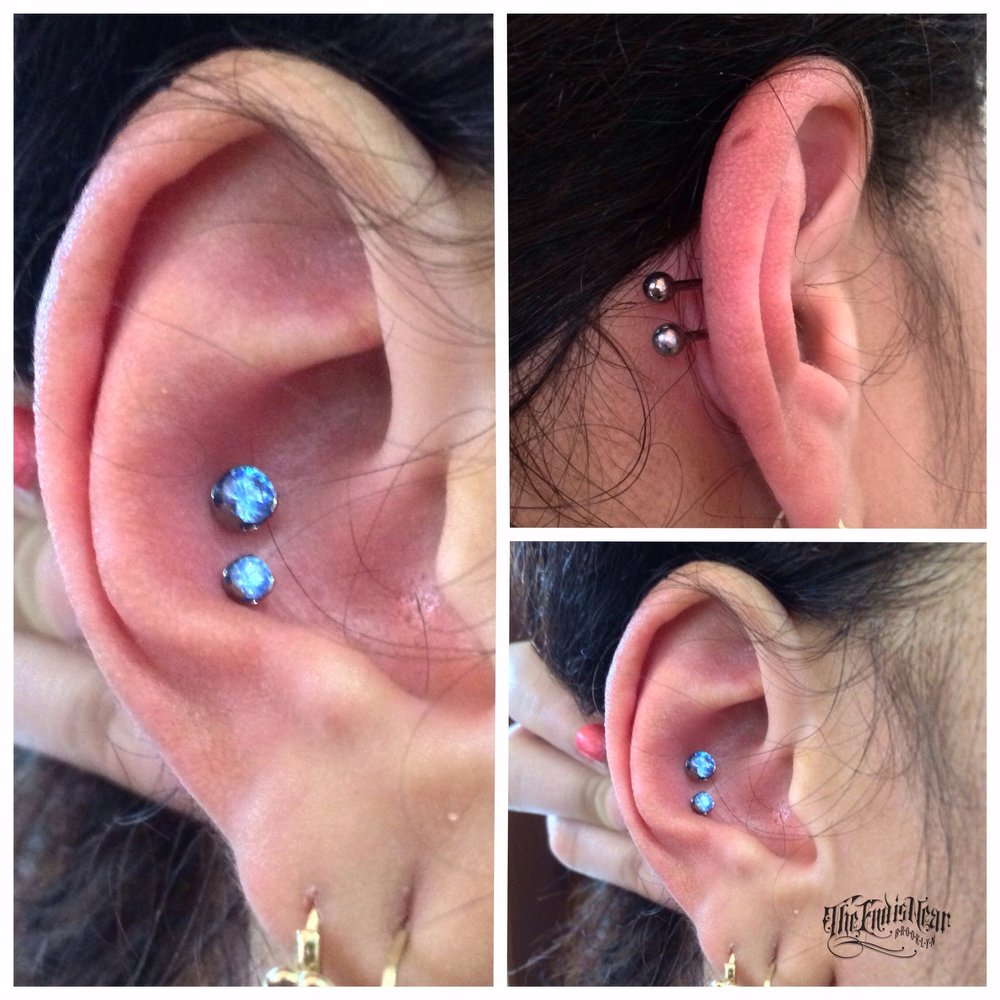 Dual Conch Piercing With Blue Dermal Anchors