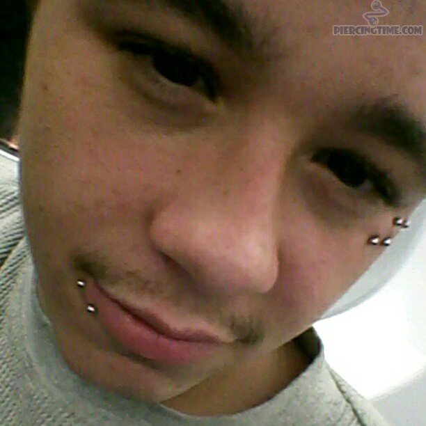 Lower Lip And Crow Feet Piercing With Silver Barbell