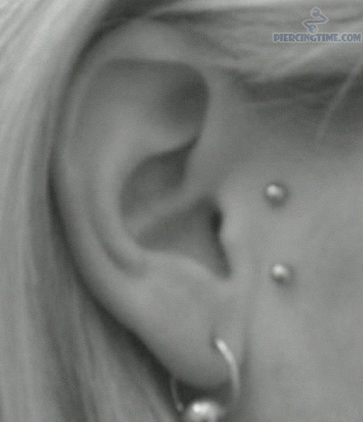 Bead Ring Lobe And Surface Tragus Piercing