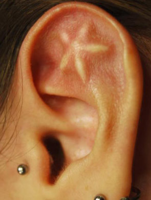 Implants Piercing On Girl Left Ear