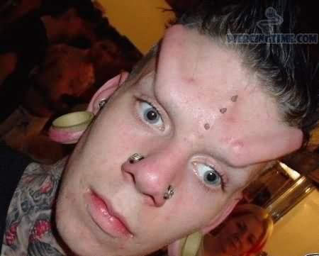 Implants Piercing On Guy Forehead