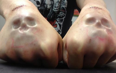 Skull Implants Piercing On Both Hands