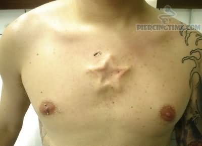 Star Implants Piercing On Chest