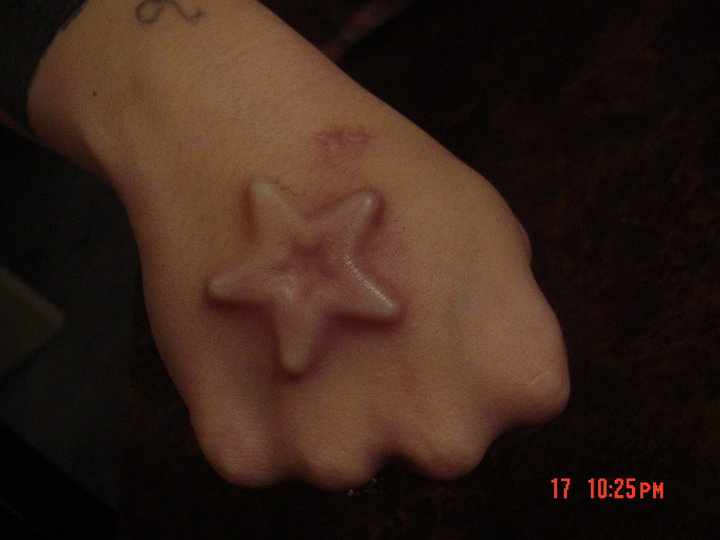 Star Implants Piercing On Girl Right Hand