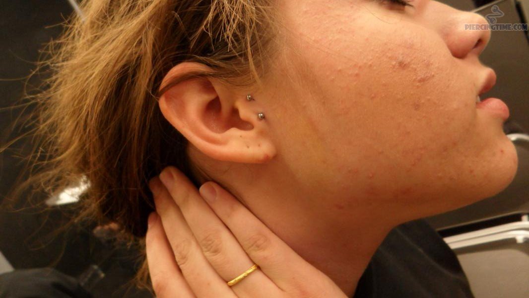 Surface Tragus Piercing On Girl Right Ear