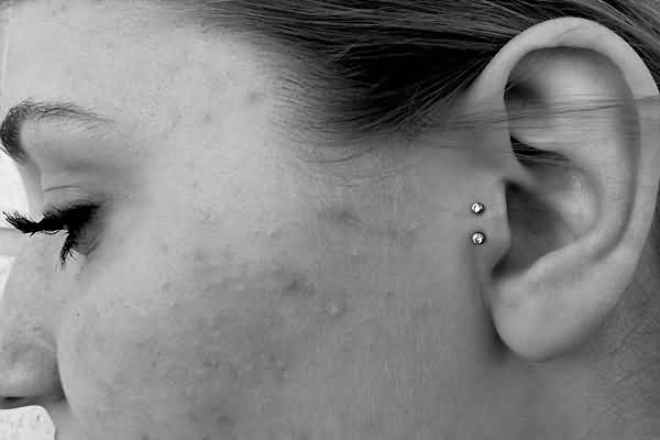 Surface Tragus Piercing With Anchors