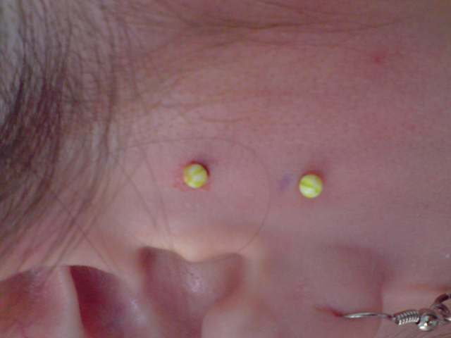 Surface Tragus Piercing With Yellow Barbell For Girls by Tristana gray