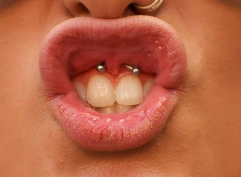 Left Dual Nostril And Lip Frenulum Piercing