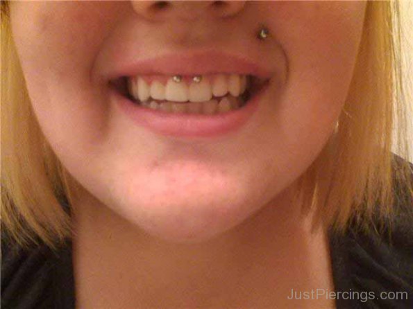 Left Monroe And Lip Frenulum Piercing With Circular Barbell