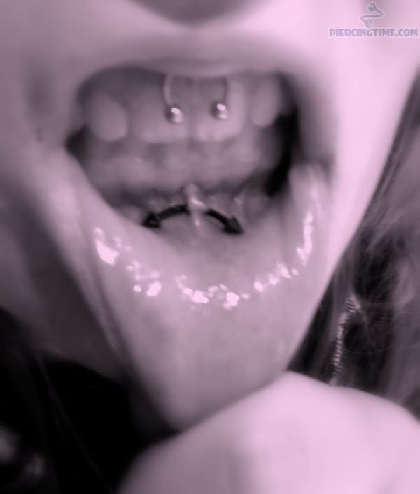 Lower Lip And Lip Frenulum Piercing With Circular Barbell