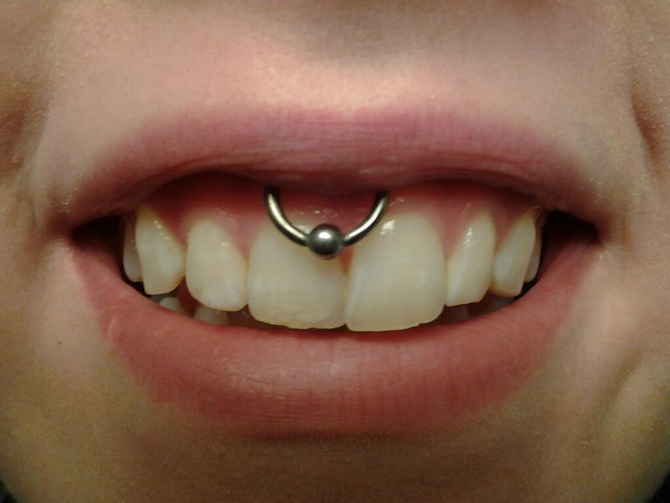 Silver Bead Ring Upper Lip Frenulum Piercing For Girls