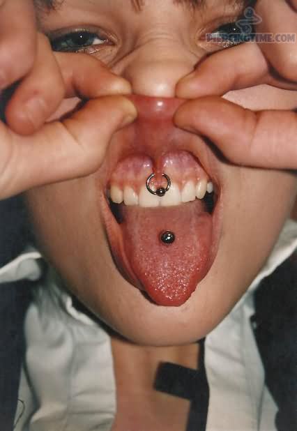 Upper Lip Frenulum Piercing With Bead Ring