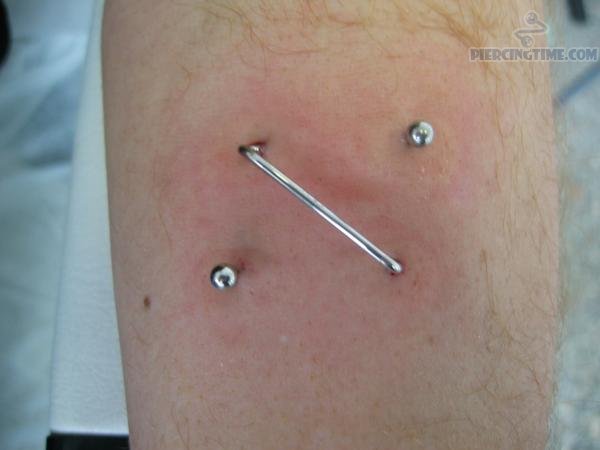 Pocketing Piercing Closeup Picture