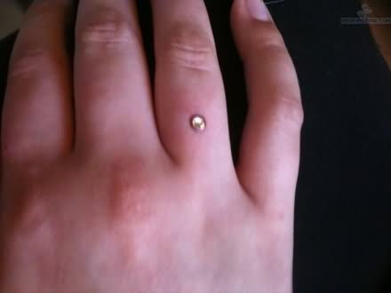 Finger Ring Piercing With Small Dermal Anchor