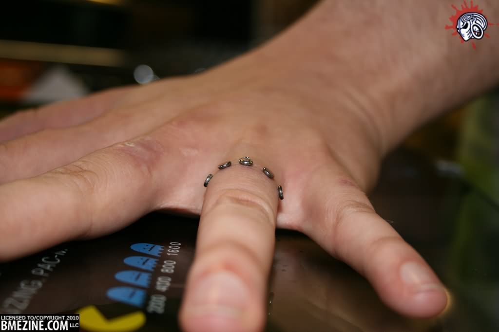 Microdermal Finger Ring Piercing