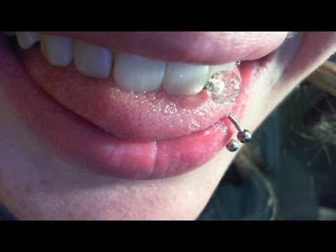 Tooth Gem And Lower Lip Beat Piercing