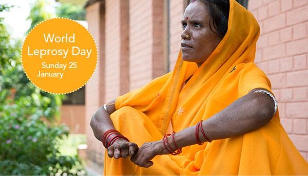 World Leprosy Day In India