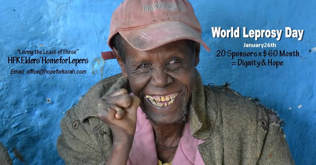 World Leprosy Day January 26th Loving The Least Of These