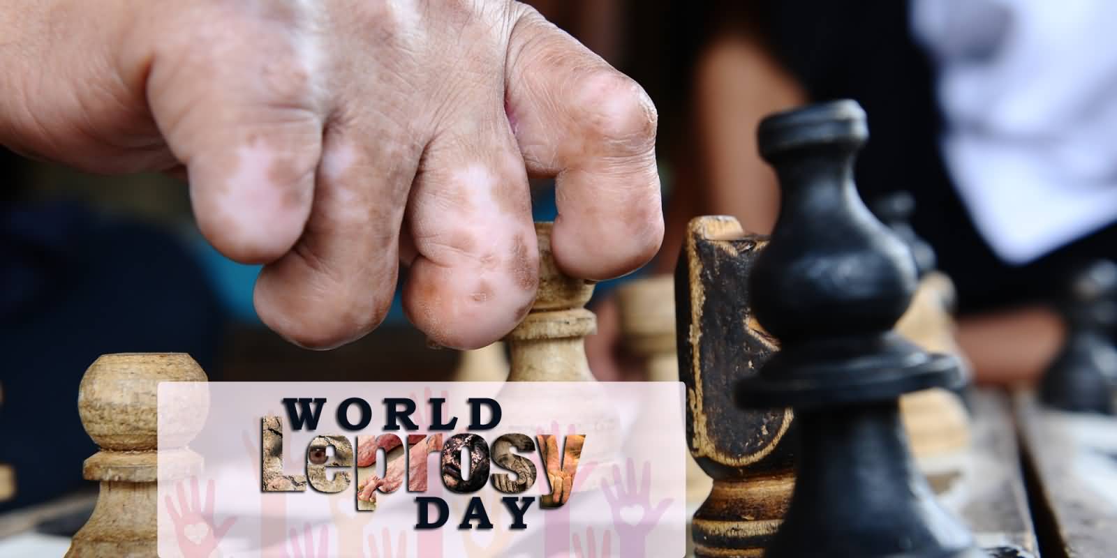 World Leprosy Day Playing Chess With Infected Hands