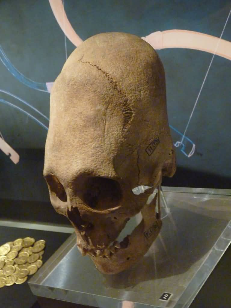 Skull Of Female Inside The Hungarian National Museum