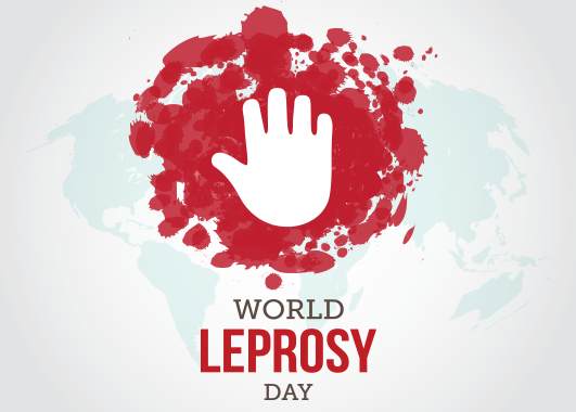 World Leprosy Day hand print on red color splash