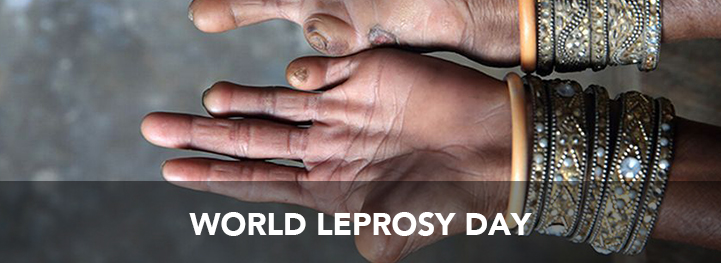 World Leprosy Day header image